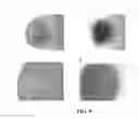 Fig. 07 - Cartilage repair systems and applications utilizing a glycosaminoglycan mimic