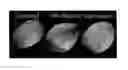 Fig. 01 - INSTILLATION OF LIPOSOMAL FORMULATION OF SIRNA AND ANTISENSE OLIGONUCLEOTIDES