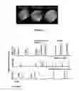 Fig. 02 - INSTILLATION OF LIPOSOMAL FORMULATION OF SIRNA AND ANTISENSE OLIGONUCLEOTIDES