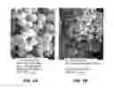 Fig. 02 - Microsphere-based composition for preventing and/or reversing new-onset autoimmune diabetes