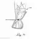 Fig. 04 - Elastomeric multi-function squeezer/strainer device