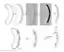 Fig. 01 - DESIGN METHOD OF SURGICAL SCAN TEMPLATES AND IMPROVED TREATMENT PLANNING