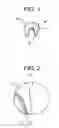 Fig. 02 - Palladium-Cobalt Based Alloys
