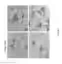 Fig. 02 - Proteoglycan splice variants as therapeutics and diagnostics for amyloid diseases