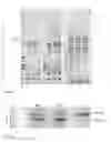 Fig. 02 - Use of EEF1A as biomarker and a method of screening MetAP2 inhibitors