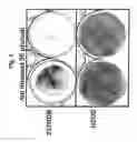 Fig. 06 - NOVEL USE OF ADENOVIRUSES AND NUCLEIC ACIDS THAT CODE FOR SAID VIRUSES