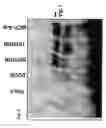 Fig. 07 - NOVEL USE OF ADENOVIRUSES AND NUCLEIC ACIDS THAT CODE FOR SAID VIRUSES