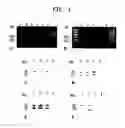 Fig. 02 - Diagnostic method for diseases by screening for hepcidin in human or animal tissues, blood or body fluids and therapeutic uses therefor