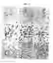 Fig. 03 - Diagnostic method for diseases by screening for hepcidin in human or animal tissues, blood or body fluids and therapeutic uses therefor