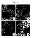 Fig. 06 - Diagnostic method for diseases by screening for hepcidin in human or animal tissues, blood or body fluids and therapeutic uses therefor