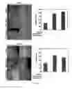 Fig. 20 - Micro-RNAs as Markers for Tumor Progression
