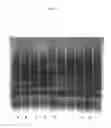 Fig. 02 - PROCESS FOR OBTAINING A CONCENTRATE OF VON WILLEBRAND FACTOR OF A COMPLEX OF FACTOR VIII/VON WILLEBRAND FACTOR AND USE OF THE SAME