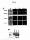 Fig. 04 - METHODS FOR TREATING NEOPLASIA AND FOR IDENTIFYING COMPOSITIONS USEFUL IN SUCH THERAPY