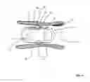 Fig. 02 - Lumen-traveling biological interface device and method of use
