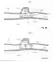 Fig. 48 - Lumen-traveling biological interface device and method of use