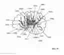 Fig. 75 - Lumen-traveling biological interface device and method of use