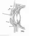 Fig. 07 - Surgical Eye Drape And Method Of Use Thereof
