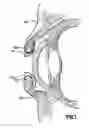 Fig. 08 - Surgical Eye Drape And Method Of Use Thereof