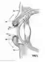 Fig. 09 - Surgical Eye Drape And Method Of Use Thereof