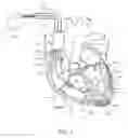 Fig. 02 - Method, System and Device for Acoustic and Photonic Tomography