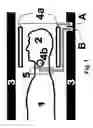 Fig. 02 - Device and method for measuring contrast agent