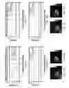 Fig. 09 - MOTION COMPENSATION IN NUCLEAR IMAGING