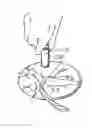 Fig. 01 - Tissue sampling tool