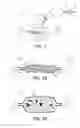 Fig. 02 - Negative pressure device