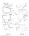 Fig. 02 - Elastic brace assembly and methods of use
