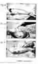 Fig. 06 - Interface layer wound dressing