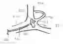 Fig. 01 - Apparatus and methods for accessing the lymphatic system