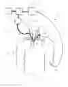 Fig. 02 - Apparatus and methods for accessing the lymphatic system