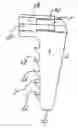 Fig. 01 - STERNUM SUTURING STAPLE