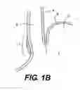 Fig. 03 - Device for fastening tissue layers