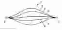 Fig. 01 - INTRAVASCULAR DEVICE, METHOD FOR MANUFACTURING SAME, AND KITS INCLUDING SAME