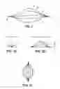 Fig. 02 - INTRAVASCULAR DEVICE, METHOD FOR MANUFACTURING SAME, AND KITS INCLUDING SAME