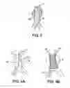 Fig. 03 - INTRAVASCULAR DEVICE, METHOD FOR MANUFACTURING SAME, AND KITS INCLUDING SAME