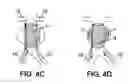 Fig. 04 - INTRAVASCULAR DEVICE, METHOD FOR MANUFACTURING SAME, AND KITS INCLUDING SAME