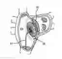 Fig. 01 - Steerable atrial septal occluder implantation device with flexible neck