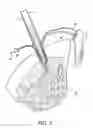 Fig. 06 - Knotless graft fixation using an implant having a pointed tip