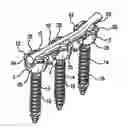 Fig. 01 - Spinal fixation system having locking and unlocking devices for use with a multi-planar, taper lock screw