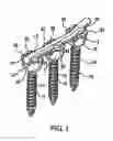 Fig. 02 - Spinal fixation system having locking and unlocking devices for use with a multi-planar, taper lock screw