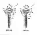 Fig. 04 - Spinal fixation system having locking and unlocking devices for use with a multi-planar, taper lock screw