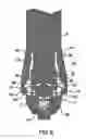 Fig. 09 - Spinal fixation system having locking and unlocking devices for use with a multi-planar, taper lock screw