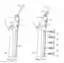 Fig. 22 - System for treating bone fractures