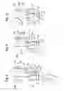 Fig. 04 - RECEIVING PART FOR RECEIVING A ROD FOR COUPLING THE ROD TO A BONE ANCHORING ELEMENT,  BONE ANCHORING DEVICE, METHOD AND TOOL FOR ASSEMBLING THE SAME