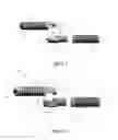 Fig. 03 - Distal interphalangeal fusion method and device