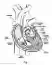 Fig. 02 - Prosthetic heart valve
