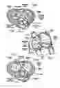 Fig. 03 - Prosthetic heart valve
