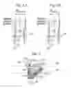 Fig. 05 - Prosthetic heart valve